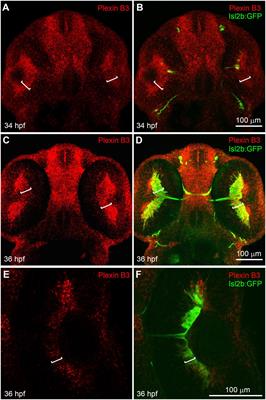 Plexin B3 guides axons to cross the midline in vivo